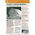 Jaundice in Healthy Newborns